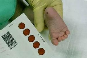 Анализ крови из пяточки младенца